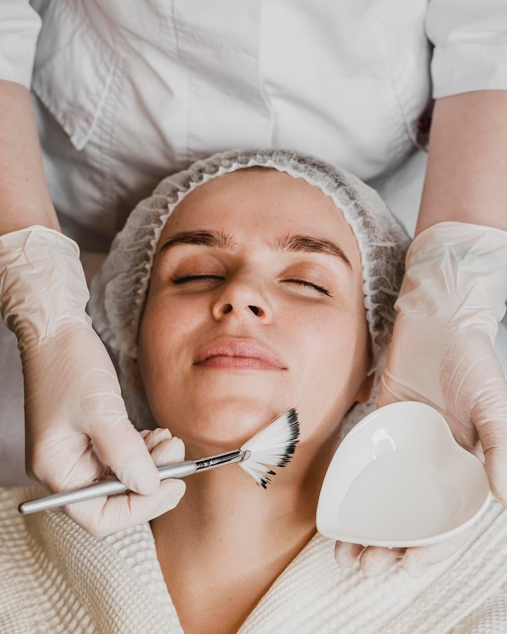 peeling quimico facial