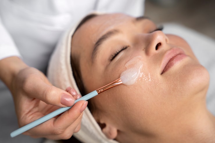peeling quimico facial